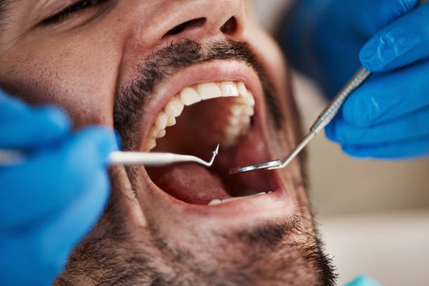 Best Emergency Treatment for Oral Infections in Little Falls, NY
